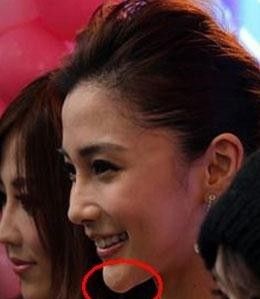 Angelababy旧素颜照曝光酷似凤姐 被指整容失败