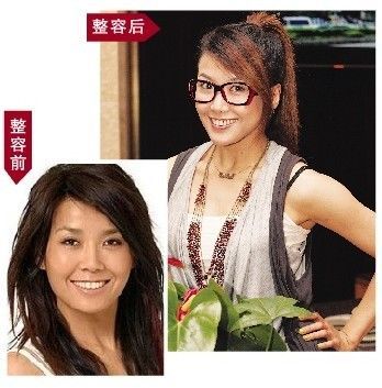 王蓉整容前后对比