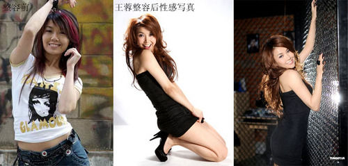 王蓉整容前后对比