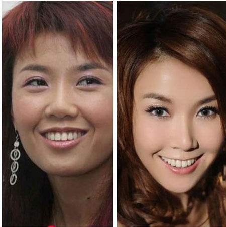 王蓉整容前后对比