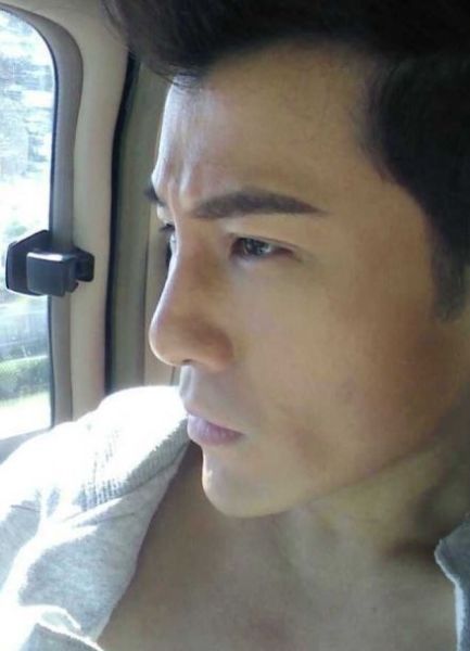 许绍洋整容惊悚大变脸网友惊叹：像苏志燮