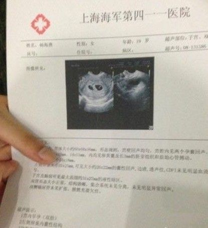 少女堕胎晒图遭炮轰 