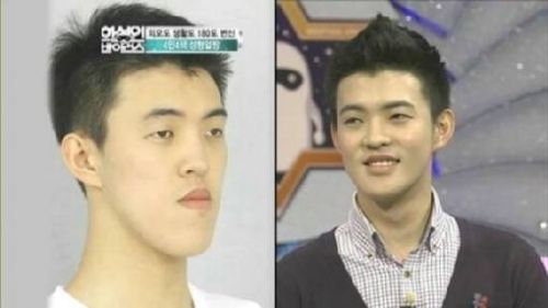 尹恩惠朴有天文根英李敏镐 韩星整容前后对比照