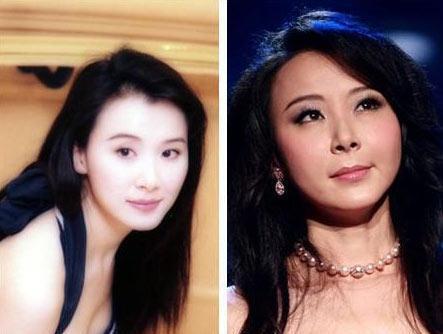 李小璐林志玲杨幂 整容女星动刀部位大揭秘