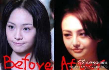 郑爽整容前后对比照曝光