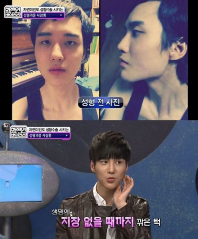 韩国 整形中毒男 手术50次改造自己 手机新浪网