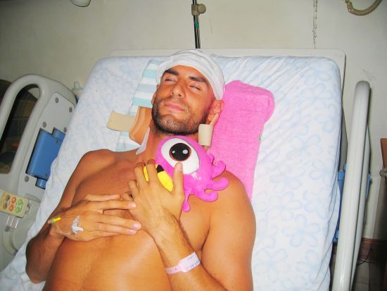 卢西亚诺颅骨重伤