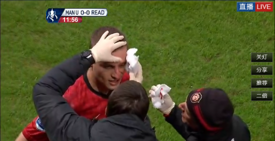 维迪奇也受伤挂彩