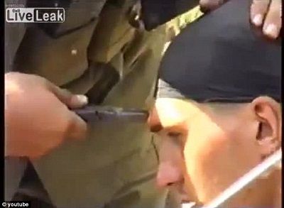这名士兵的战友用老虎钳将射入额头的子弹拔出