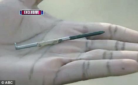 射入这名建筑工人心脏的铁钉长10厘米