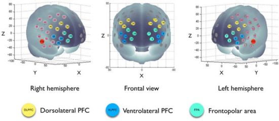 　nirs.jpg图片来源：Brun et al., 2014。