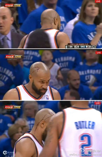 鱼豆豆也被开瓢了……