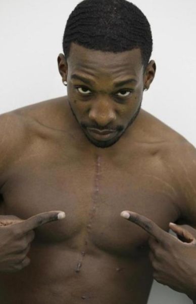 一道闪电般的伤疤贯穿格林的胸口