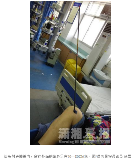 看着好疼。。。