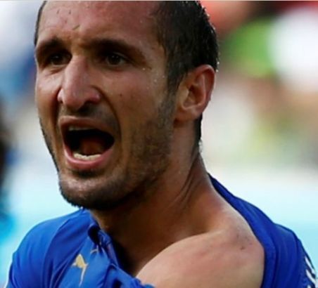 不知道苏亚雷斯的牙有没有毒啊……