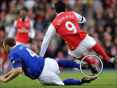 足坛断腿惨剧:当场断三截 郑智废神锋(图)