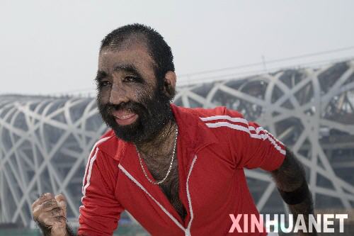 图文-"毛孩"参加火炬手报名 毛孩向未来奔跑